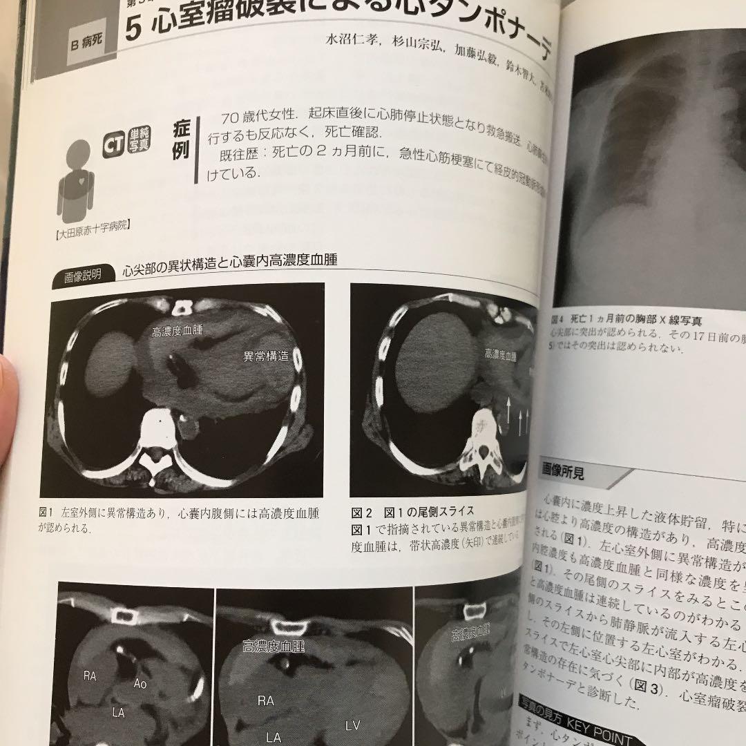オートプシー・イメージング読影ガイド