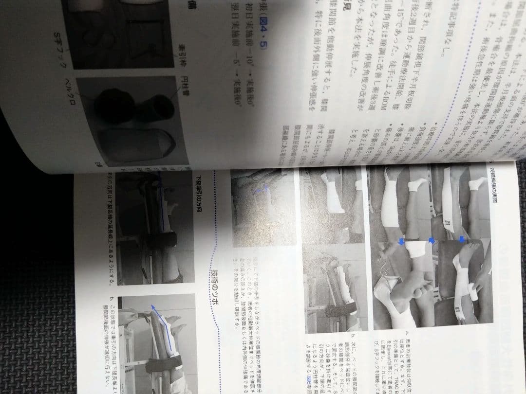 整形外科運動療法ナビゲーション　関節機能解剖学に基づく 下肢体幹　理学療法　PT
