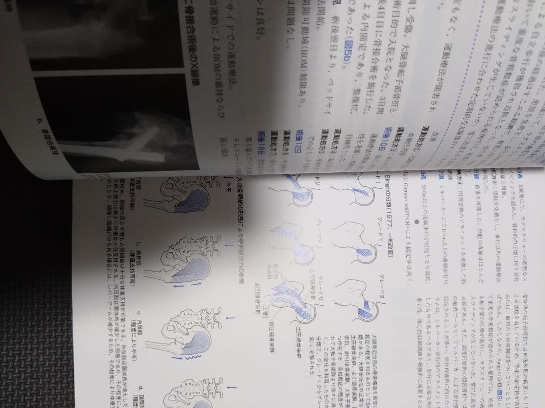 整形外科運動療法ナビゲーション　関節機能解剖学に基づく 下肢体幹　理学療法　PT